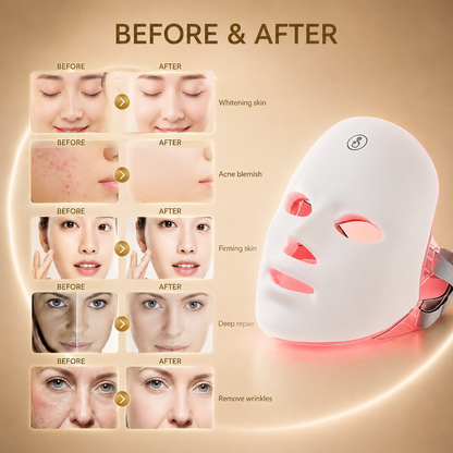 HaloGlow™ Skin Renewal System